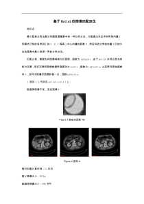 基于Matlab的图像特征识别及匹配