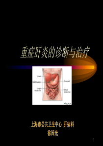 重症肝炎的诊断与治疗