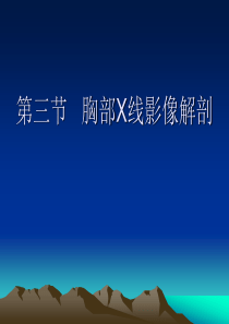 胸部X线影像解剖