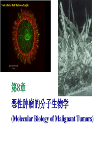 恶性肿瘤的分子生物学