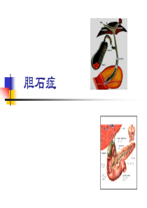 三、胆石症