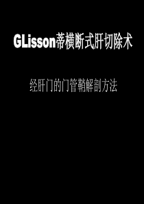 GLisson蒂横断式肝切除术--经肝门的门管鞘解剖方法