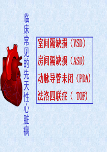 常见的几种先心病ppt课件