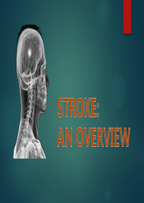 Stroke