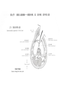 膝关节手术入路