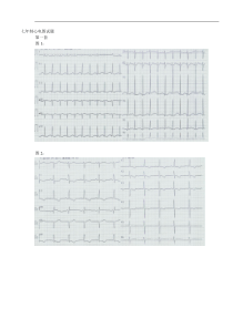 心电图试题(卷)与标准答案解析