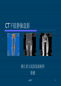 CT下肢静脉造影【放射科】--ppt课件