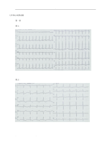 心电图试题(卷)与标准答案解析