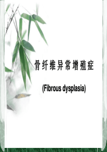 骨-纤-维-异-常-增-殖-症