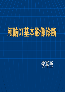 颅脑CT基本影像诊断