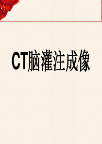 CT灌注成像