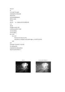 同态滤波及matlab实现