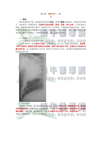 病例分析——肺炎