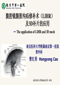 腹腔镜腹股沟疝修补术