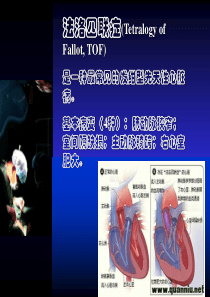 法洛四联症(精品课件)强烈推荐