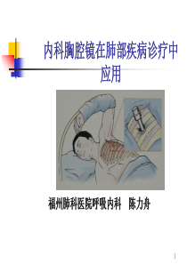 内科胸腔镜-PPT