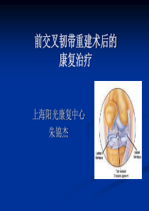 前交叉韧带重建术