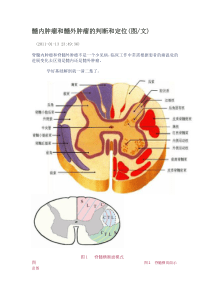 髓内肿瘤与髓外肿瘤.总结