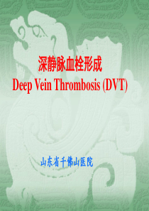 深静脉血栓形成(DVT)