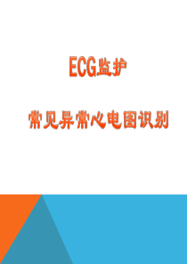 ECG监护及常见异常心电图的识别