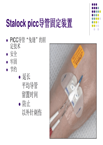 Stalock-picc导管固定装置(思乐扣)