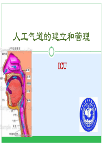 19人工气道的护理