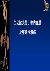 主动脉夹层、壁内血肿及穿通性溃疡的影像诊断与鉴别诊断