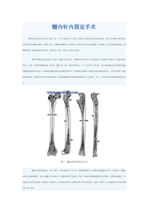 髓内针内固定手术