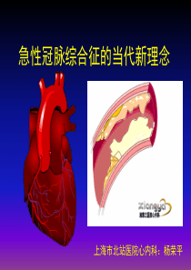 急性冠脉综合征的当代新理念(讲稿)1