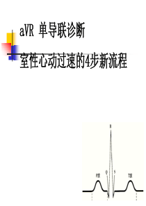 AVR鉴别诊断室性和室上性心动过速