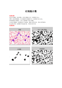 图像处理—红细胞计数(Matlab)