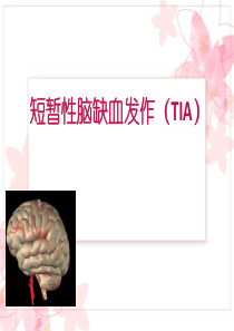 TIA的鉴别与诊断