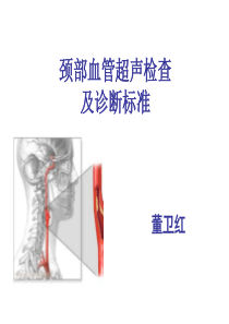 颈部血管超声检查及诊断标准