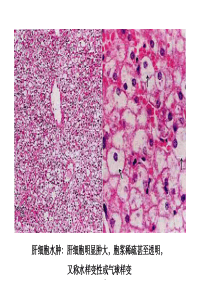 病理图片描述47张