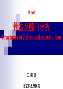 第75章-骨盆及髋臼骨折(王满宜)(《外科学》8年制第2版配套)