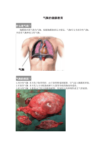 气胸的健康宣教