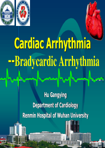 心律失常arrhythmia