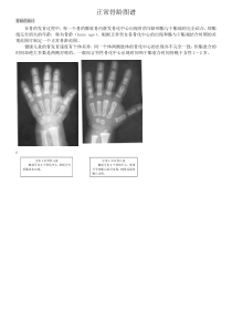 骨龄之对照标准