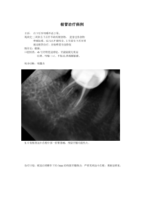 根管治疗病例