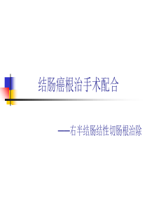 结肠癌根治手术