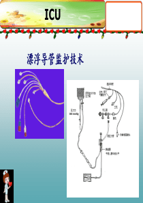 漂浮导管测力值及意义