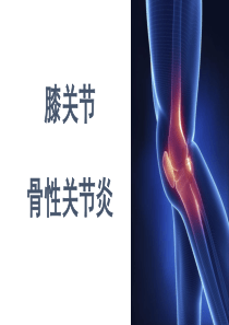 《膝关节骨性关节炎》PPT课件