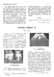 超声诊断小儿膀胱结石1例