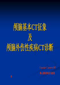 颅脑基本CT征象及颅脑外伤性疾病CT诊断