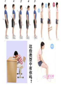 上交叉综合症康复