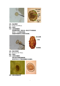 寄生虫虫卵镜下图片汇总