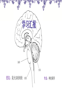 脑桥梗死&孤立性脑桥梗死