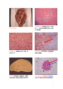 病理学图片