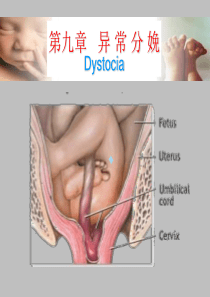 第九章异常分娩ppt课件