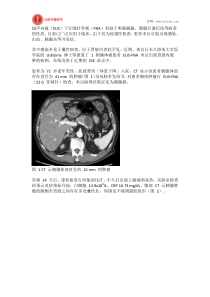 北医李睿医考：超声内镜细针穿刺术后合并胃壁内脓肿